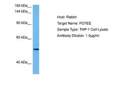 POTEE Rabbit anti-Human, Polyclonal, Novus Biologicals 0.1ml; Unconjugated:Antibodies,